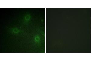 Immunofluorescence analysis of HeLa cells, using Neutrophil Cytosol Factor 1 (Ab-304) antibody. (NCF1 Antikörper)