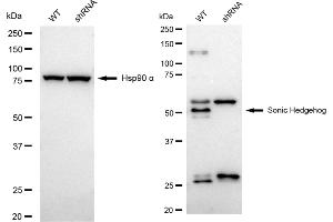 Western blotting analysis using sonic hedgehog antibody (ABIN7800969). (Rekombinanter Sonic Hedgehog Signaling Molecule Antikörper)