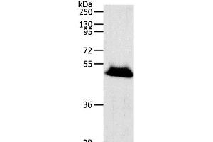 Western Blot analysis of Human liver cancer tissue using RBMS3 Polyclonal Antibody at dilution of 1:1000 (RBMS3 Antikörper)