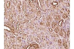 Paraformaldehyde-fixed, paraffin embedded rat kidney; Antigen retrieval by boiling in sodium citrate buffer (pH6) for 15min; Block endogenous peroxidase by 3% hydrogen peroxide for 30 minutes; Blocking buffer (normal goat serum) at 37°C for 20min; Antibody incubation with ATBF1 Polyclonal Antibody, Unconjugated (bs-11805R) at 1:200 overnight at 4°C, followed by a conjugated secondary and DAB staining. (ZFHX3 Antikörper  (AA 301-400))