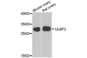 Western blot analysis of extract of mouse ovary and rat ovary cells, using ULBP2 antibody. (ULBP2 Antikörper)