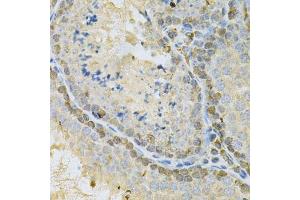 Immunohistochemistry of paraffin-embedded mouse testis using BUB1 Antibody. (BUB1 Antikörper  (AA 1-300))