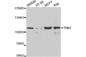 TNK2 Antikörper  (AA 70-385)