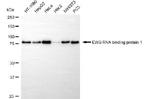 anti-Ewing Sarcoma Breakpoint Region 1 (EWSR1) antibody