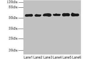 Western blot All lanes: PHF10 antibody at 8 μg/mL Lane 1: Hela whole cell lysate Lane 2: 293T whole cell lysate Lane 3: A2780 whole cell lysate Lane 4: U251 whole cell lysate Lane 5: A549 whole cell lysate Lane 6: A375 whole cell lysate Secondary Goat polyclonal to rabbit IgG at 1/10000 dilution Predicted band size: 57, 56, 52 kDa Observed band size: 57 kDa (PHF1 Antikörper  (AA 151-360))