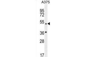 Western Blotting (WB) image for anti-Adaptor-Related Protein Complex 1, mu 1 Subunit (AP1M1) antibody (ABIN2996504) (AP1M1 Antikörper)