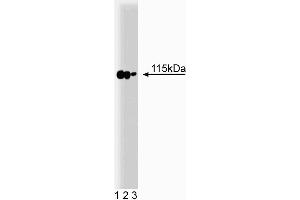 Western blot analysis of p115 on a rat cerebrum lysate. (ARHGAP4 Antikörper  (AA 843-955))