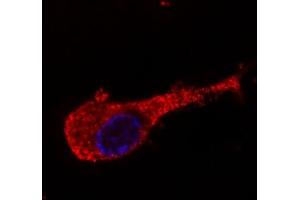 Immunofluorescence staining of neurofilament medium protein in murine Neuro2A cells by antibody conjugated with Dyomics 547 (red). (NEFM Antikörper)