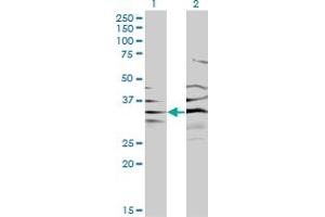 Western Blotting (WB) image for anti-3'(2'), 5'-Bisphosphate Nucleotidase 1 (BPNT1) (AA 1-101) antibody (ABIN599133) (BPNT1 Antikörper  (AA 1-101))