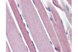 Hexokinase 2 antibody was used for immunohistochemistry at a concentration of 4-8 ug/ml. (Hexokinase 2 Antikörper  (N-Term))