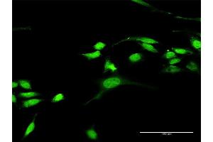 Immunofluorescence of purified MaxPab antibody to RASGRP3 on HeLa cell.