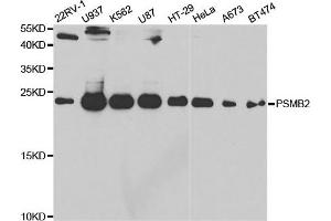 Western Blotting (WB) image for anti-Proteasome (Prosome, Macropain) Subunit, beta Type 2 (PSMB2) antibody (ABIN1876671) (PSMB2 Antikörper)