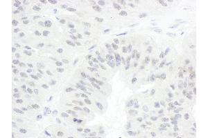 Immunohistochemistry (IHC) image for anti-Cell Division Cycle 20 Homolog (S. Cerevisiae) (CDC20) (AA 50-100) antibody (ABIN7454390)