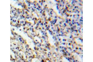 Used in DAB staining on fromalin fixed paraffin-embedded spleen tissue (MYO1G Antikörper  (AA 754-1018))