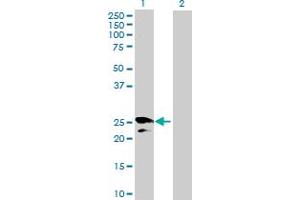 Western Blot analysis of HPGD expression in transfected 293T cell line by HPGD MaxPab polyclonal antibody. (HPGD Antikörper  (AA 1-266))