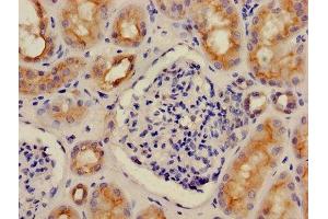 Immunohistochemistry (IHC) image for anti-ATPase, H+ Transporting, Lysosomal 13kDa, V1 Subunit G1 (ATP6V1G1) (AA 2-118) antibody (ABIN7175262)