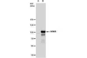 WB Image IKK beta antibody detects IKK beta protein by western blot analysis. (IKBKB Antikörper  (C-Term))