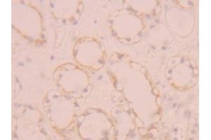 Detection of FGFR1 in Human Kidney Tissue using Polyclonal Antibody to Fibroblast Growth Factor Receptor 1 (FGFR1) (FGFR1 Antikörper  (AA 236-362))