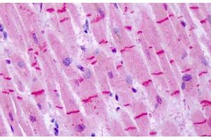 Anti-GRM8 / MGLUR8 antibody IHC staining of human heart. (GRM8 Antikörper  (N-Term))