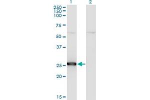 Western Blot analysis of TK1 expression in transfected 293T cell line by TK1 monoclonal antibody (M04), clone 1D10.