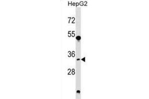 Western Blotting (WB) image for anti-Spermidine Synthase (SRM) antibody (ABIN2999104) (Spermidine Synthase Antikörper)