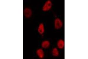 ABIN6274352 staining HepG2 cells by IF/ICC. (E2F2 Antikörper  (Internal Region))
