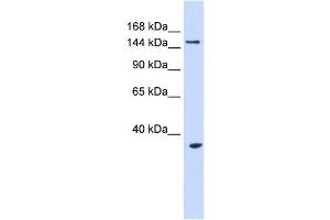 UBE3B antibody used at 1 ug/ml to detect target protein. (UBE3B Antikörper  (Middle Region))