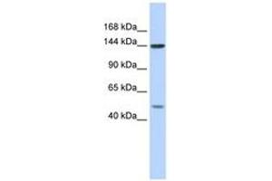 Image no. 1 for anti-Splicing Factor 3b, Subunit 1, 155kDa (SF3B1) (AA 287-336) antibody (ABIN6743003) (SF3B1 Antikörper  (AA 287-336))