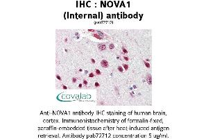 Image no. 1 for anti-Neuro-Oncological Ventral Antigen 1 (NOVA1) (Internal Region) antibody (ABIN1737442) (NOVA1 Antikörper  (Internal Region))