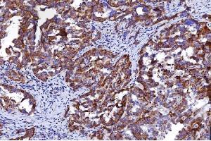 IHC analysis of HGS using anti-HGS antibody (ABIN7601207).