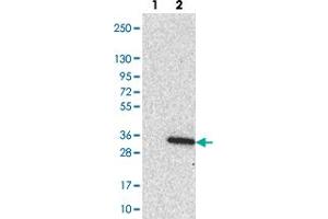 Western blot analysis of Lane 1: Negative control (vector only transfected HEK293T lysate). (LRRC18 Antikörper)