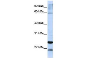GSTA4 antibody used at 1 ug/ml to detect target protein.