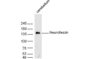 Mouse cerebellum lysates probed with Neurofascin Polyclonal Antibody, unconjugated  at 1:300 overnight at 4°C followed by a conjugated secondary antibody at 1:10000 for 60 minutes at 37°C. (NFASC Antikörper  (AA 501-650))