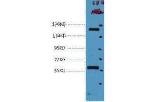 Western Blotting (WB) image for anti-Protein tyrosine Phosphatase, Receptor Type, C (PTPRC) antibody (ABIN3181116) (CD45 Antikörper)