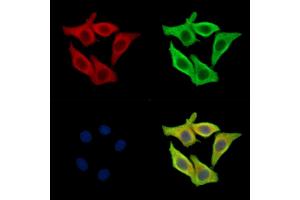 ABIN7095030 and ABIN7099086 staining Hela cells by IF/ICC. (TMEM199 Antikörper)