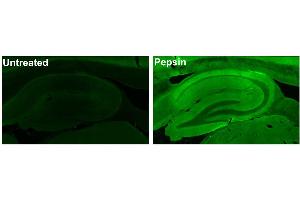 Adult rat hippocampus immunofluorescence under standard protocol (left) and with antigen retrieval via pepsin pretreatment (right).