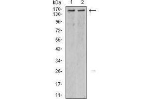 Western Blotting (WB) image for anti-Lysine (K)-Specific Demethylase 6A (KDM6A) (AA 1252-1401) antibody (ABIN5542642)