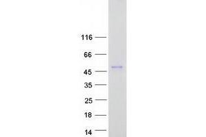 Western Blotting (WB) image for ALX Homeobox 3 (ALX3) protein (Myc-DYKDDDDK Tag) (ABIN2714644)