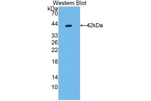 Detection of Recombinant VCC1, Rat using Polyclonal Antibody to VEGF Co Regulated Chemokine 1 (VCC1) (CXCL17 Antikörper  (AA 23-119))