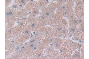 Detection of NOTCH4 in Human Liver Tissue using Polyclonal Antibody to Notch Homolog 4 (NOTCH4) (NOTCH4 Antikörper  (AA 1715-2001))