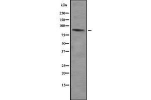 Western blot analysis of ZNF785 using HepG2 whole cell lysates (ZNF785 Antikörper)