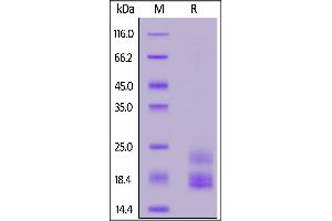 SDS-PAGE (SDS) image for Interleukin 17A (IL17A) (AA 26-158) (Active) protein (His tag) (ABIN5526596)