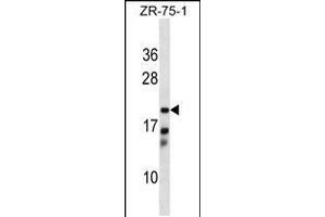 Western blot analysis in ZR-75-1 cell line lysates (35ug/lane). (CBR4 Antikörper  (C-Term))