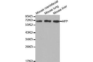 Western blot analysis of extracts of various cell lines, using AFP antibody. (alpha Fetoprotein Antikörper  (AA 360-609))