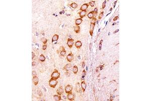 Immunohistochemistry (Paraffin-embedded Sections) (IHC (p)) image for anti-Cell Growth Regulator with EF-Hand Domain 1 (CGREF1) (AA 220-248), (C-Term) antibody (ABIN1881716)