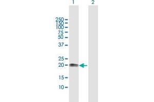 Western Blot analysis of VSTM2L expression in transfected 293T cell line by VSTM2L MaxPab polyclonal antibody.