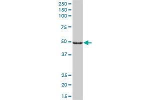 Western Blotting (WB) image for anti-Cytochrome P450, Family 27, Subfamily A, Polypeptide 1 (CYP27A1) (AA 1-531) antibody (ABIN514855)