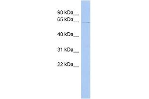 WB Suggested Anti-TIGD1 Antibody Titration: 0. (TIGD1 Antikörper  (Middle Region))