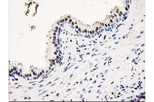 Immunohistochemical staining of paraffin-embedded Human prostate tissue using anti-SMS mouse monoclonal antibody. (SMS Antikörper)