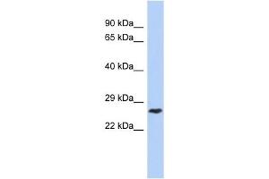 DIRAS1 antibody used at 1 ug/ml to detect target protein.